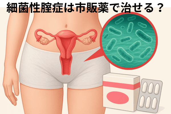 細菌性腟症は市販薬で治せる？