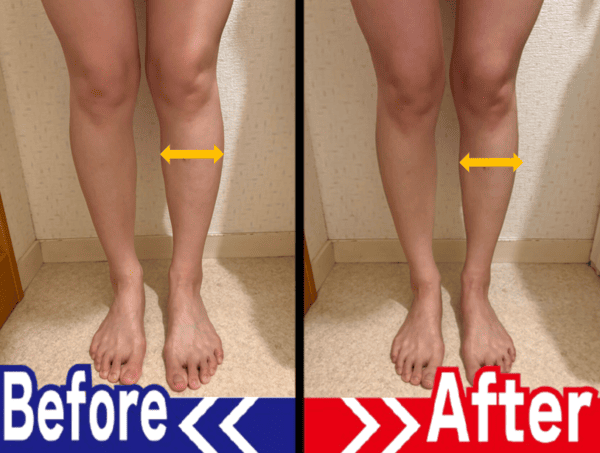 脚のビフォーアフター