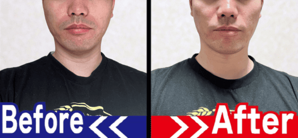 顔のビフォーアフター