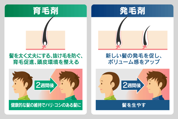 育毛剤と発毛剤の違いを解説した比較図。育毛剤は髪を太く強くして抜け毛を防ぎ、頭皮環境を整える効果。発毛剤は新しい髪の発毛を促し、ボリューム感をアップさせる効果。2週間使用後の変化をイラストで紹介。