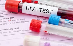 HIV（エイズ）の正しい知識