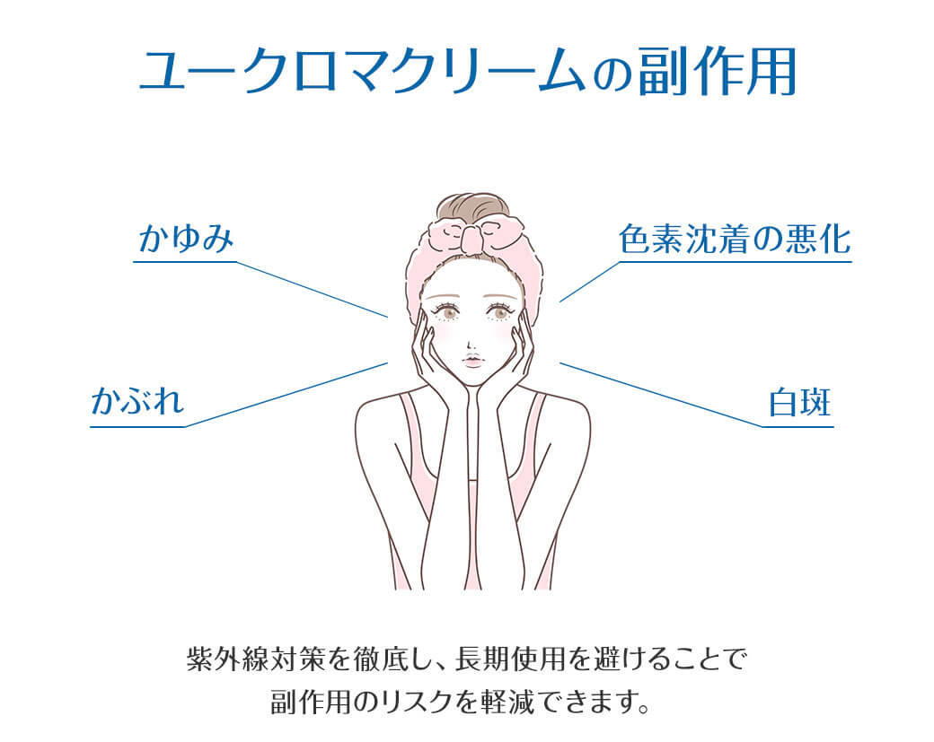 ユークロマクリームの副作用 かゆみ かぶれ 色素沈着の悪化 白斑 紫外線対策を徹底し、長期使用を避けることで副作用のリスクを軽減できます。