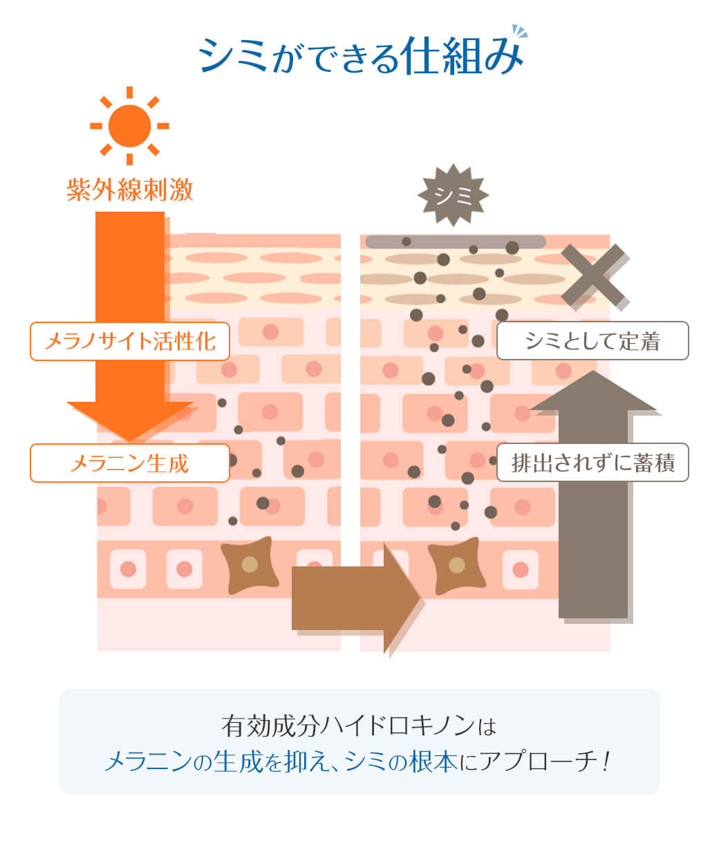 シミができる仕組み 紫外線刺激 メラノサイト活性化 メラニン生成 排出されずに蓄積 シミとして定着 有効成分ハイドロキノンはメラニンの生成を抑え、 シミの根本にアプローチ！