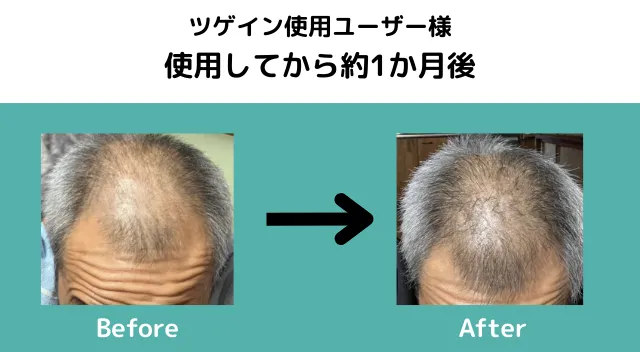 ツゲインビフォーアフター