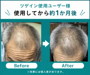ツゲインサムネイル_実際に使用した方の使用前後の写真