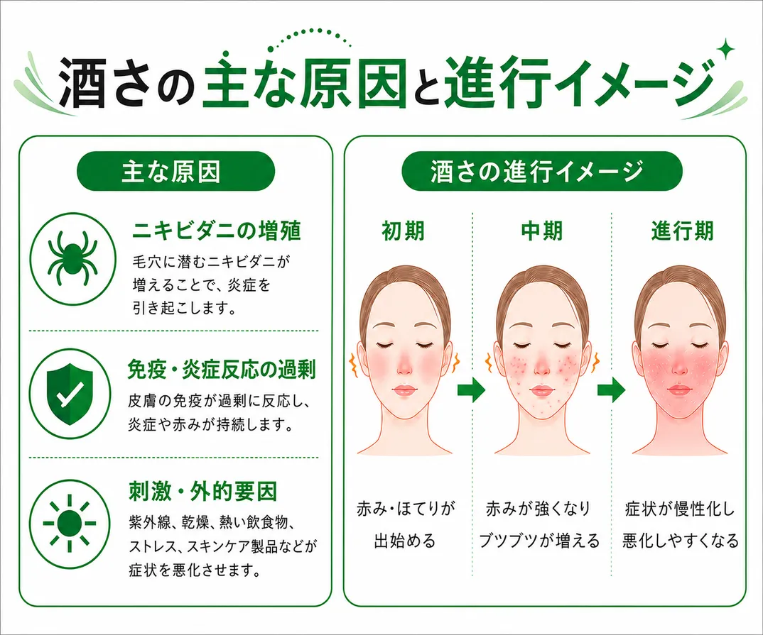 酒さの主な原因と進行イメージ　主な原因・ニキビダニの増殖・免疫、炎症反応の過剰・刺激、外的要因