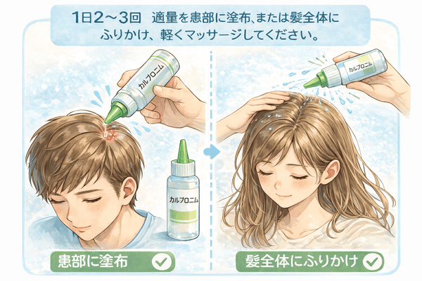 カルプロニウム塩化物外用液の使用方法。1日2～3回、脱毛部分や頭皮全体に塗布しマッサージする手順を解説したイラスト