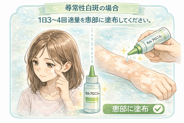尋常性白斑に対するカルプロニウム塩化物外用液の使用方法。1日3～4回、白斑部分に適量を塗布する手順を解説したイラスト