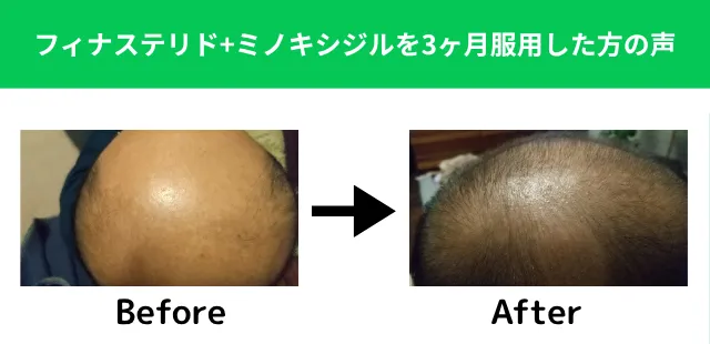 ビフォーアフターの画像