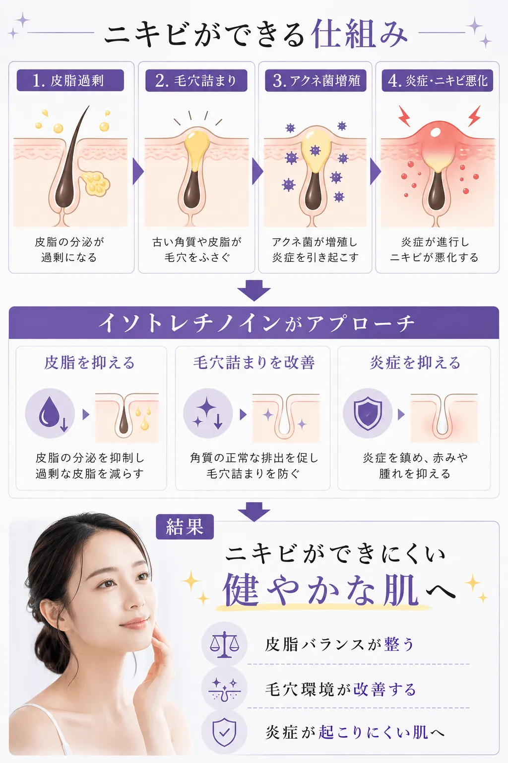ニキビができる仕組み 1．皮脂過剰	2．毛穴詰まり 	3．アクネ菌増殖	4．炎症・ニキビ悪化 イソトレチノインがアプローチ 皮脂を抑える	毛穴詰まりを改善	炎症を抑える 結果ニキビができにくい健やかな肌へ・皮脂バランスが整う・毛穴環境が改善する・炎症が起こりにくい肌へ