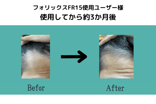 使用してから約3か月後
