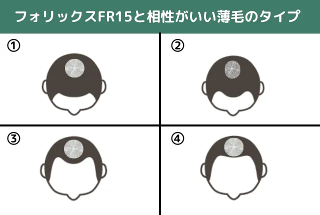 フォリックスFR15に適応している脱毛のタイプを紹介している画像