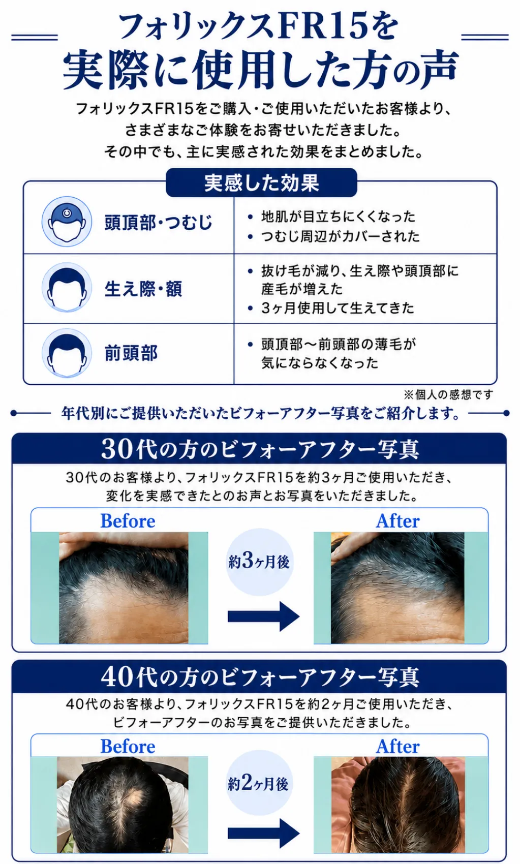 フォリックスFR15を実際に使用した方の声フォリックスFR15をご購入・ご使用いただいたお客様より、さまざまなご体験をお寄せいただきました。その中でも、主に実感された効果をまとめました。実感した効果、●頭頂部・つむじ:・地肌が目立ちにくくなった・つむじ周辺がカバーされた●生え際・額:・抜け毛が減り、生え際や頭頂部に産毛が増えた・3ヶ月使用して生えてきた●前頭部:頭頂部〜前頭部の薄毛が気にならなくなった※個人の感想です年代別にご提供いただいたビフォーアフター写真をご紹介します。●30代の方のビフォーアフター写真:30代のお客様より、フォリックスFR15を約3ヶ月ご使用いただき、変化を実感できたとのお声とお写真をいただきました。約3ヶ月使用した方のBefore・Afterを掲載●40代の方のビフォーアフター写真:40代のお客様より、フォリックスFR15を約2ヶ月ご使用いただき、ビフォーアフターのお写真をご提供いただきました。約2ヶ月使用した方のBefore・Afterを掲載して実際に使用した方の声を説明している画像