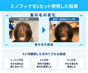 ミノフィナサムネイル_実際に1セット使用した方のビフォーアフターを紹介している画像