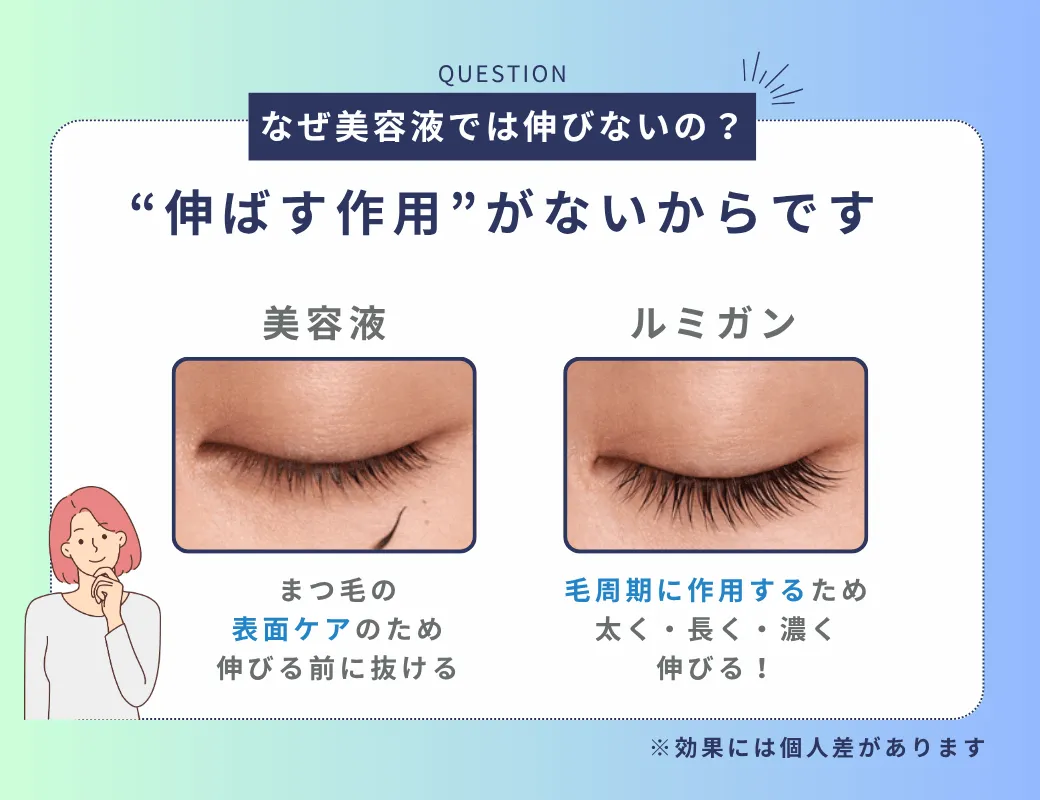 なぜ美容液では伸びないの？ “伸ばす作用”がないからです 美容液 まつ毛の表面ケアのため 伸びる前に抜ける ルミガン 毛周期に作用するため太く・長く・濃く伸びる！
