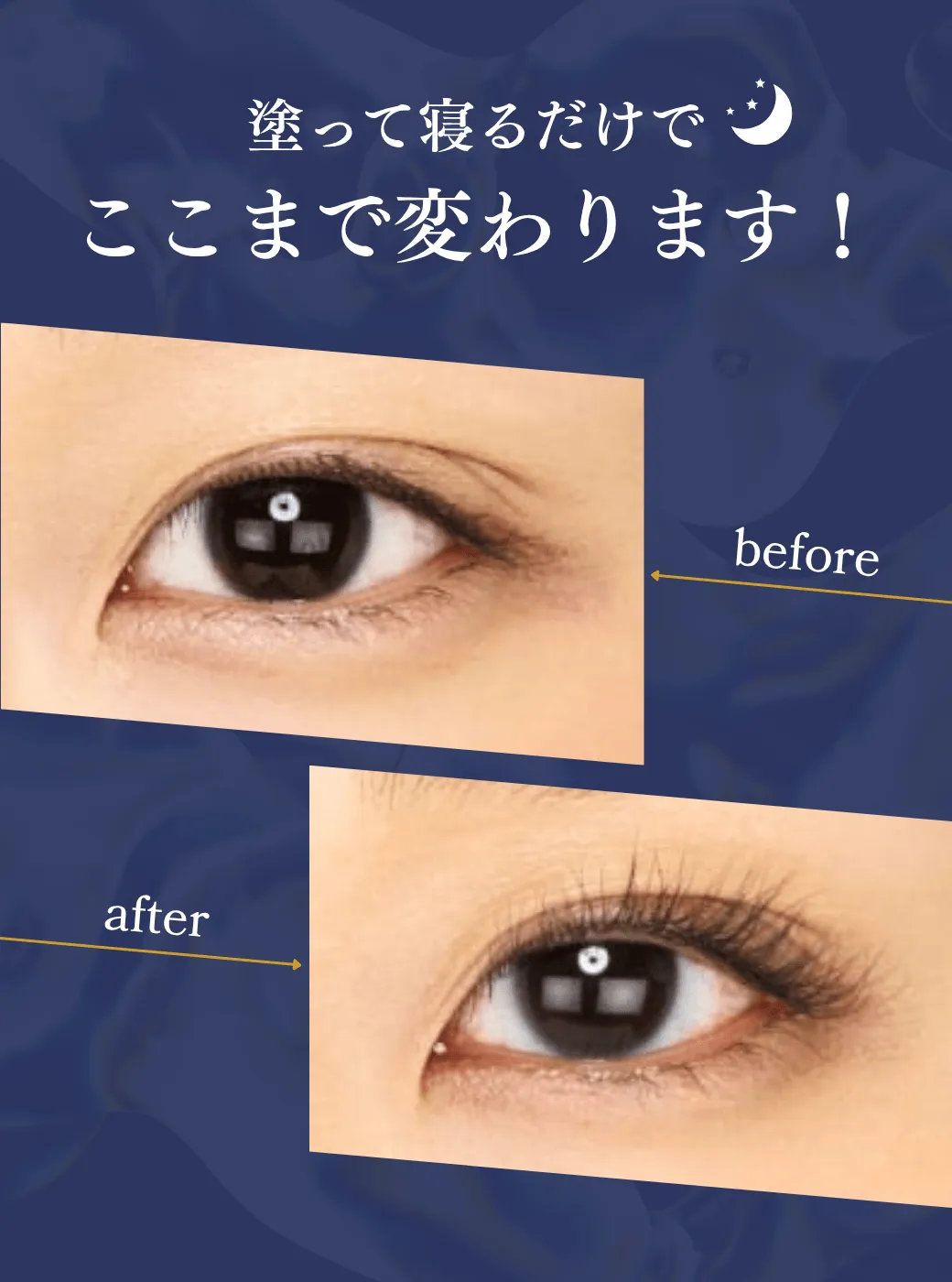 塗って寝るだけでここまで変わります！ビフォーアフター