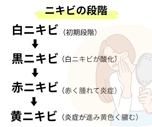 ディフェリンゲルの効果