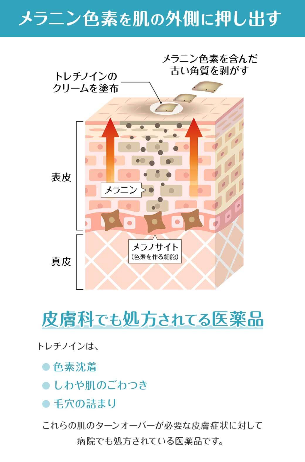 メラニン色素を肌の外側に押し出す 皮膚科でも処方されてる医薬品トレチノインは、・色素沈着・しわや肌のごわつき・毛穴の詰まりこれらの肌のターンオーバーが必要な皮膚症状に対して病院でも処方されている医薬品です。