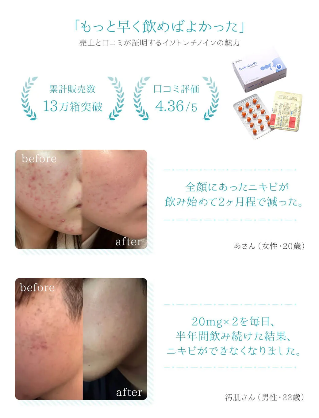 「もっと早く飲めばよかった」 売上と口コミが証明するイソトレチノインの魅力 累計販売数13万箱突破 口コミ評価4.36 /5 全顔にあったニキビが飲み始めて2ヶ月程で減った。あさん（女性・20歳） 20mg×2を毎日、半年間飲み続けた結果、ニキビができなくなりました。汚肌さん（男性・22歳）