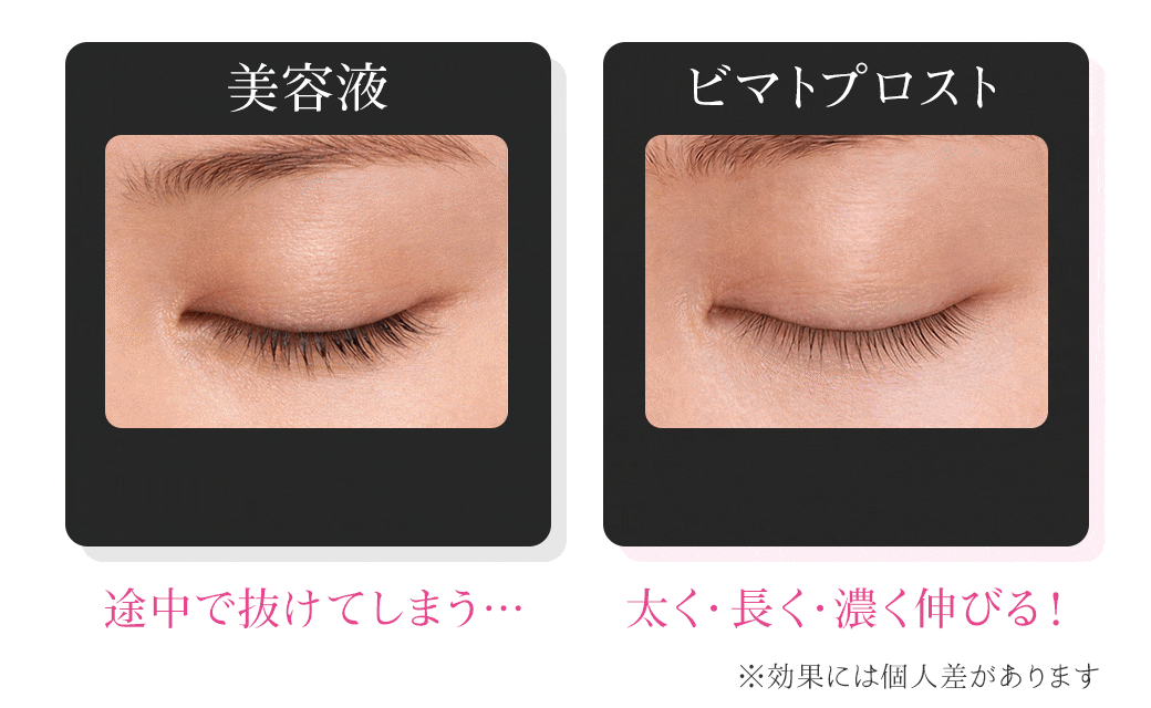 美容液とビマトプロストの違い